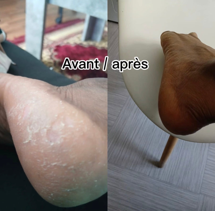 Pieds